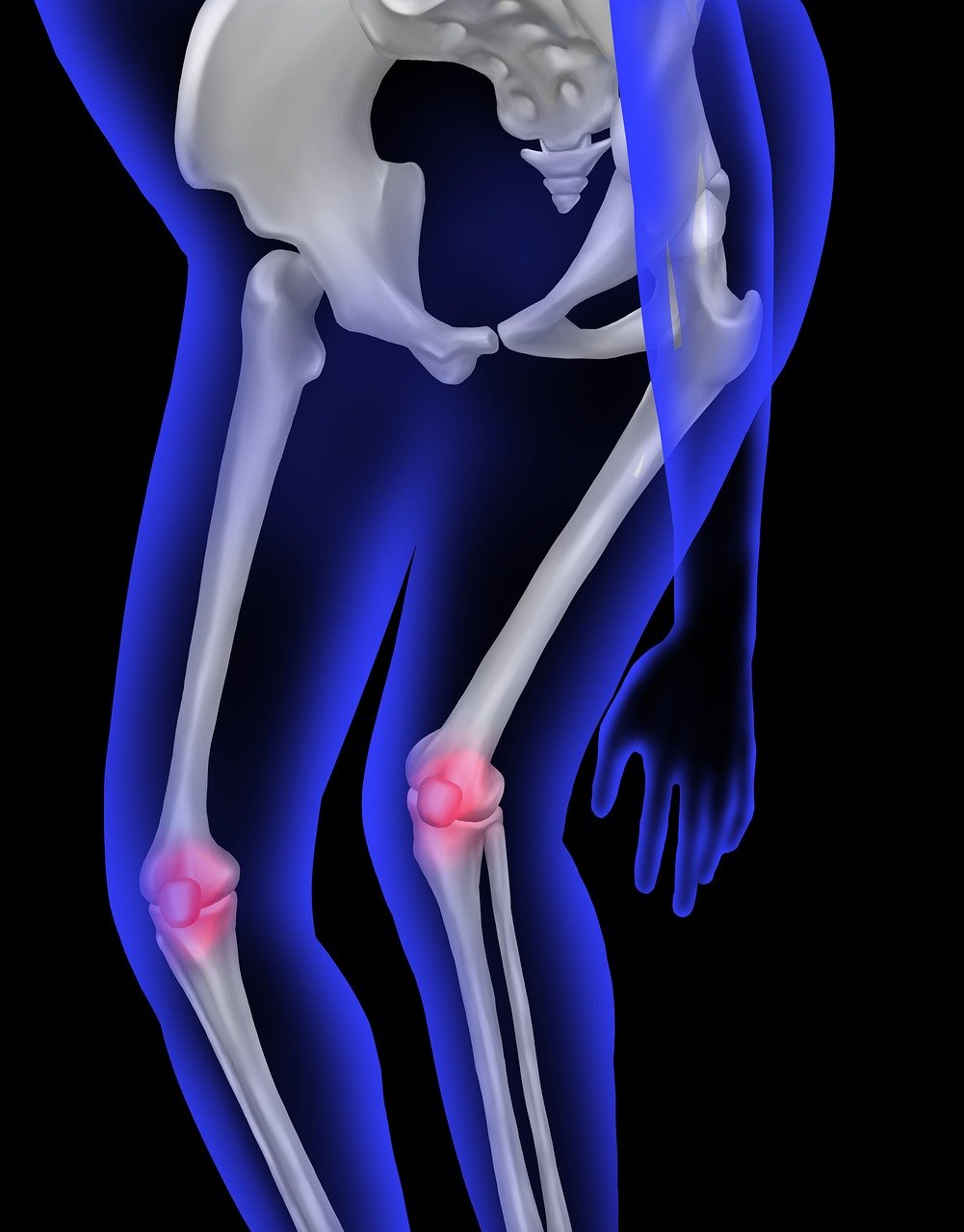 human bone, anatomy, knee pain, patella, leg pain, orthopedics-9769788.jpg